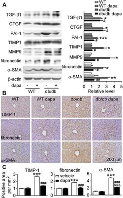 Dapagliflozin protects against nonalcoholic steatohepatitis in db/db mice